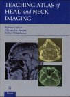 Teaching Atlas of Head and Neck Imaging
