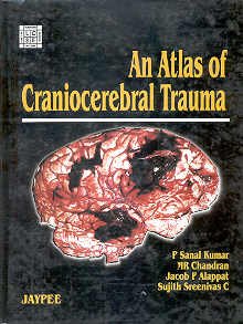 An Atlas of Craniocerebral Trauma ( India )