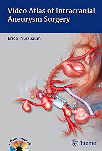 Video Atlas of Intracranial Aneurysm Surgery Book/DVD Package