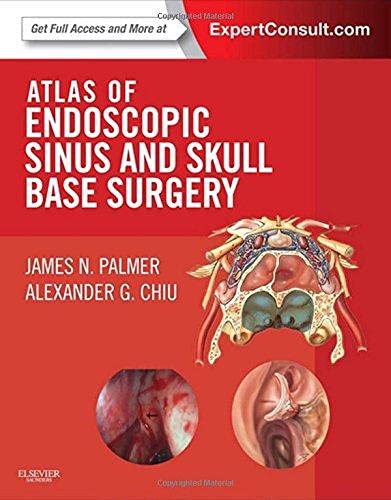Atlas of Endoscopic Sinus and Skull Base Surgery: Expert Consult - Online and Print ,Ed. :1