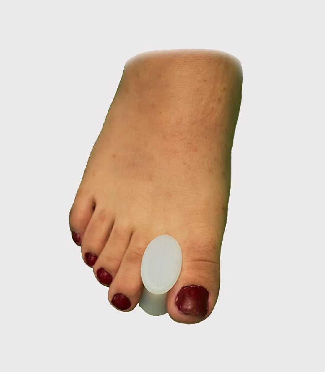 L Finger Separator