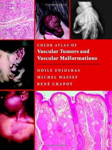 Color Atlas of Vascular Tumors and Vascular Malformations ,Ed. :1