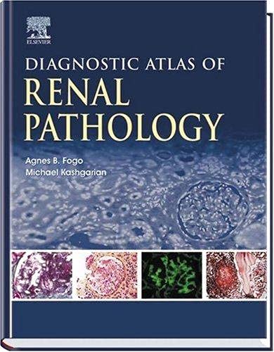 Diagnostic Atlas of Renal Pathology