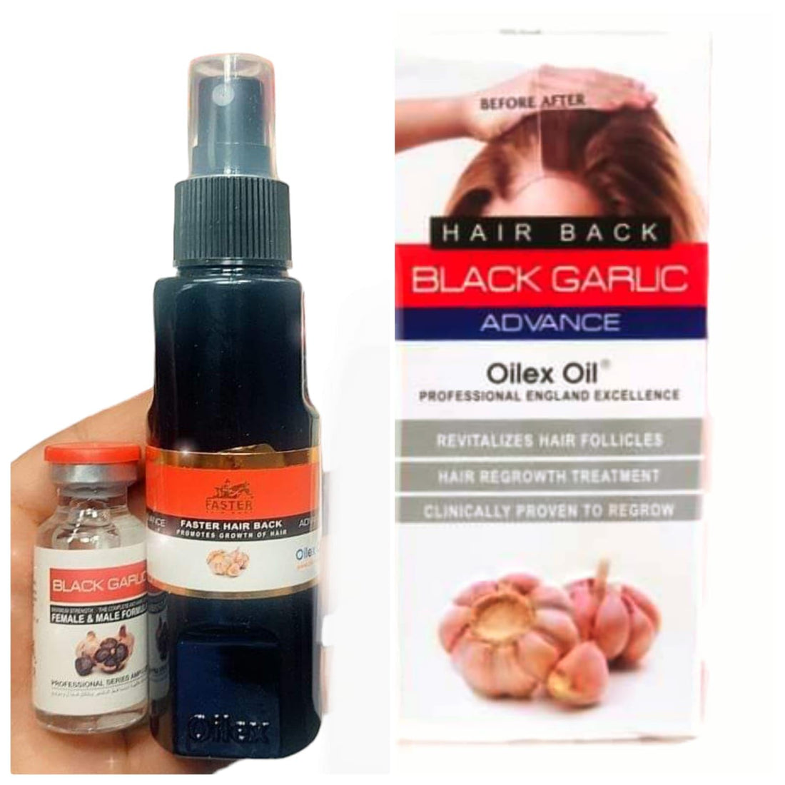 Wampoule Fast Garlic Oil for Intensive Hair Loss Treatment