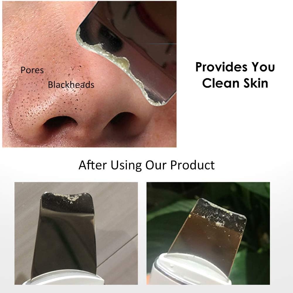 Ultrasonic Skin Peeling Device for Face – Deep Pore Cleaner Facial Scrubber Blackhead Remover, Anti Wrinkle Anti Aging Beauty Tool, Exfoliating Skin Scraper, Smooths Skin, Spa Home Skincare Daily Use