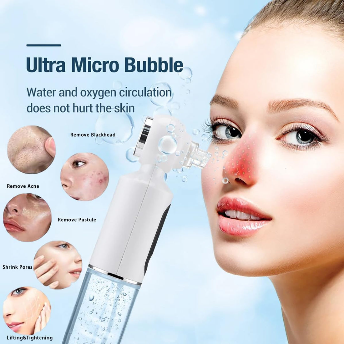 Menqshahayd Acne Pore Vacuum Cleaner-XN 8030 Beautiful Skin Care Expert Blackhead Remover