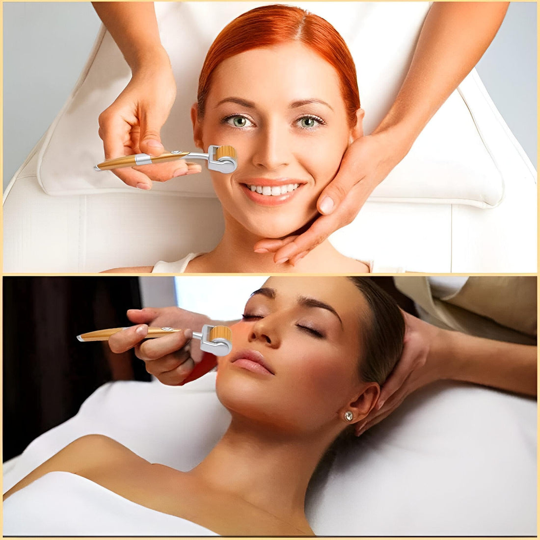 Derma Roller with Titanium Microneedles - Elevate Your Skin Care Protein with Innovative Tool to Effectively Treat Acne Scars, Stretch Marks and Hair Loss!