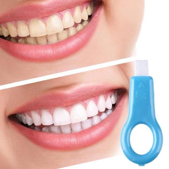 SMILE CONFIDENTLY WITH "SUN BRIGHT"! Effective Whitening Removes Tea, Coffee, Smoking Stains! With 10 Refills For Long Lasting Use! Practical Solution Used - Generic