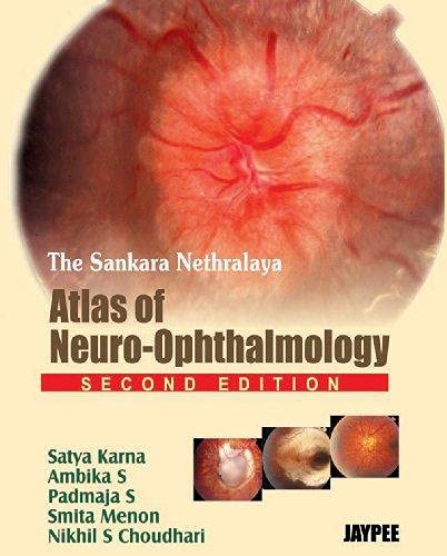 The Sankara Nethralaya Atlas of Neuro-Ophthalmology