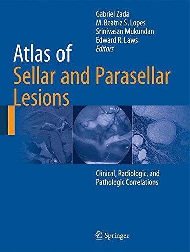 atlas of Sellar and Parasellar Lesions: Clinical, Radiologic, and Pathologic Correlations ,ed. :1