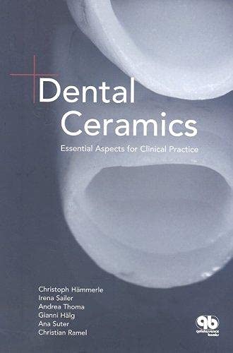 Christoph Hammerle - Irena Sailer - Andrea Thoma - Gianni Halg Dental Ceramics: Essential Facts for Cosmetics Dentists (Essential Aspects for Clinical Practice)