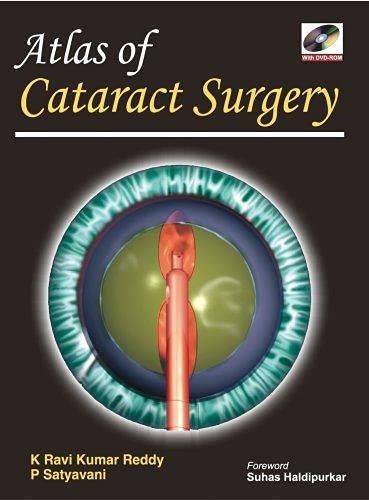 Atlas of Cataract Surgery ,Ed. :1
