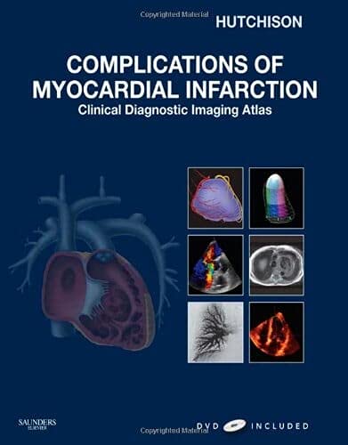 Complications of Myocardial Infarction: Clinical Diagnostic Imaging Atlas with DVD