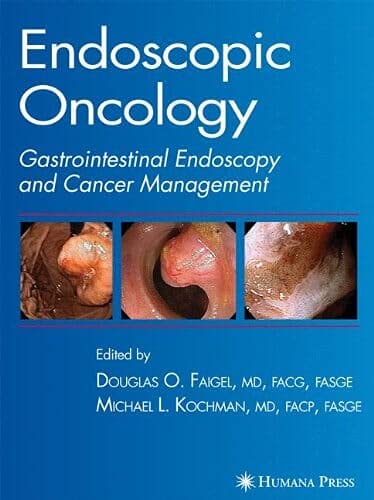 Endoscopic Oncology, Edition 1 by Douglas O. Faigel