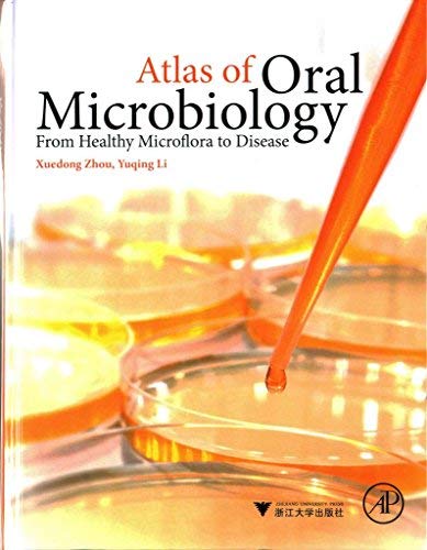 Atlas of Oral Microbiology: From Healthy Microflora to Disease