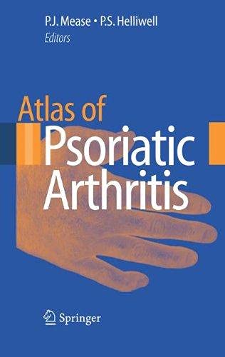 Springer Atlas of Psoriatic Arthritis