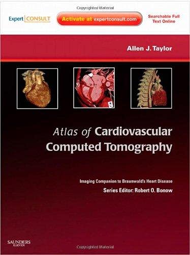 Atlas of Cardiovascular Computed Tomography: Imaging Companion to Braunwald`s