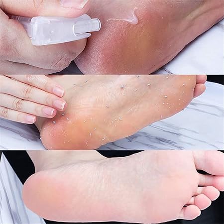"Silkfoot Spray" - Brings you total comfort and softness to your feet in seconds! no need to worry about dry feet, this spray removes dead skin and soa - Generic