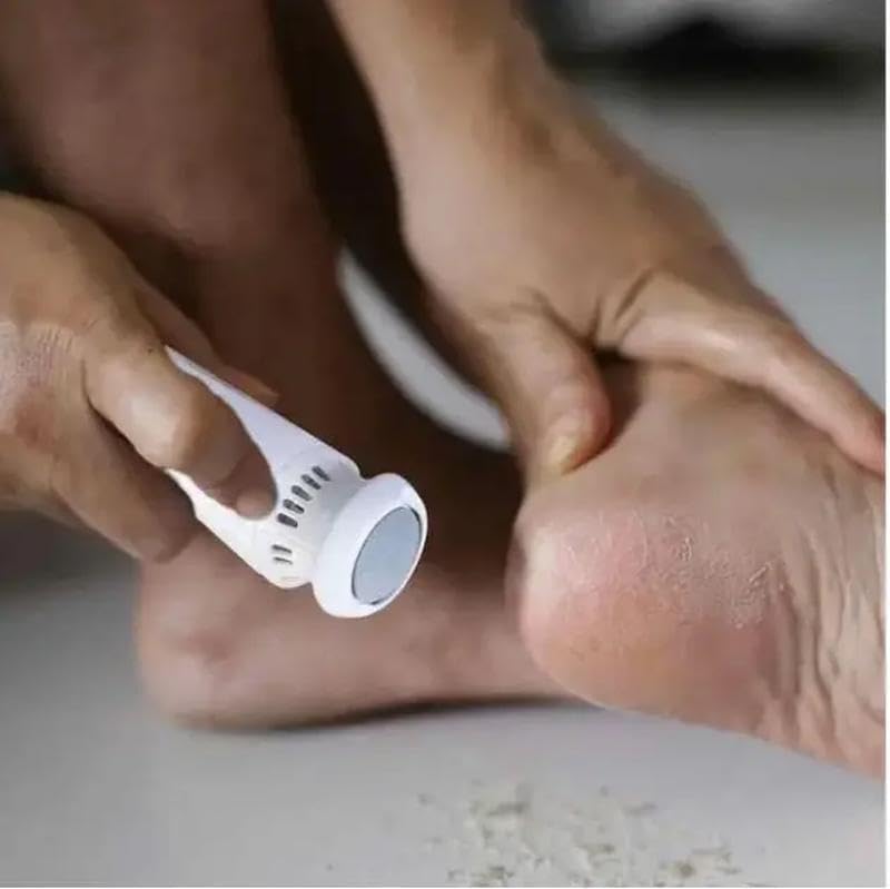 Electric Foot File Callus Remover Rechargeable Pedicure Tool For Dead Skin Hard Cracked Heels Exfoliator Roller Waterproof Grooming Kit Feet Care Smooth Skin
