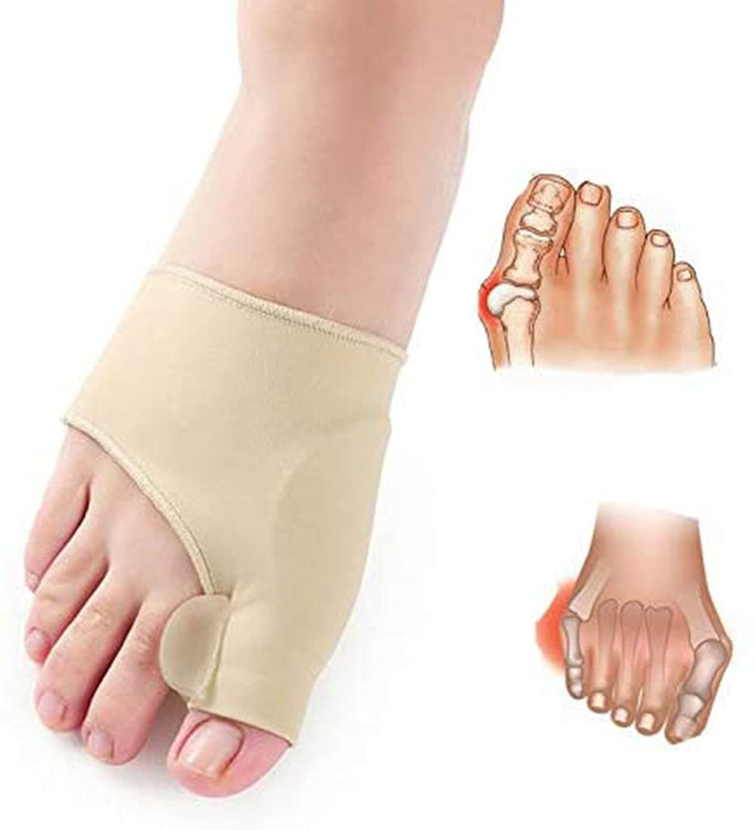 Orthopedic Bunion Corrector Socks, Silicone Hallux Valgus Toe Separator Brace, Big Toe Alignment Foot Pain Relief Tool