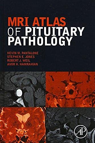 MRI Atlas of Pituitary Pathology