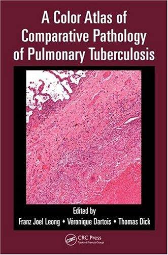 A Color Atlas of Comparative Pathology of Pulmonary Tuberculosis , Ed. :1