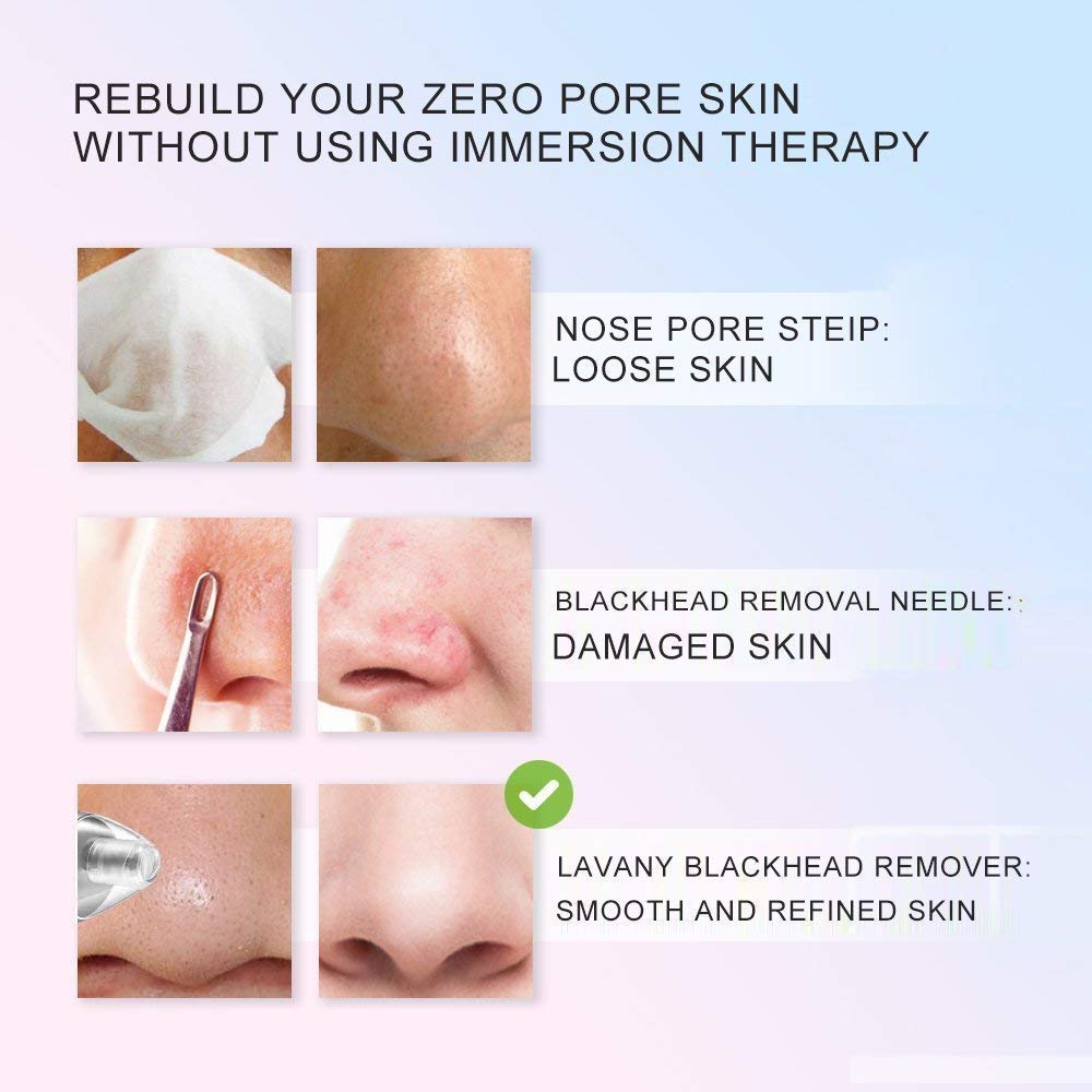 Octopus prime Electronic Blackhead Acne Remover Portable Facial Pore Cleaner Vacuum Extractor Tool Blackhead Cleaner Acne Remover Tool Kit