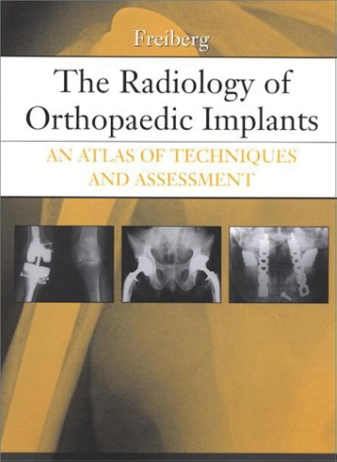 Mosby The Radiology of Orthopaedic Implants: An Atlas of Techniques and Assessment