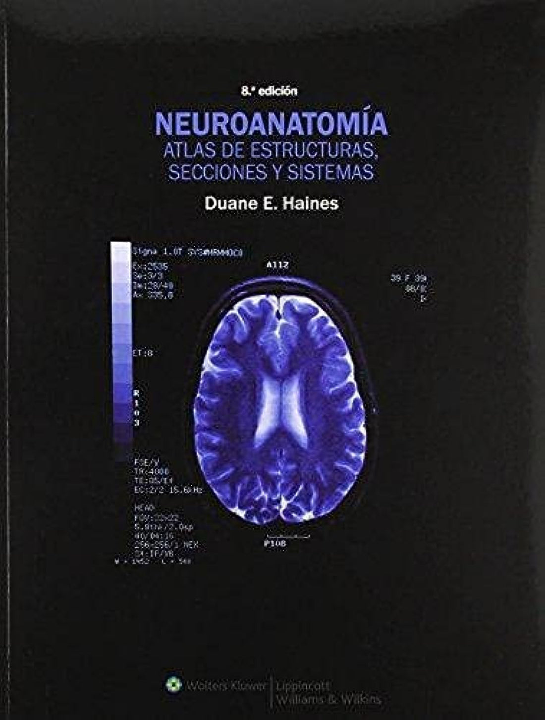 Lippincott Williams And Wilkins Neuroanatomia :NeuroAnatomy: Atlas de estructuras, secciones y sistemas ,Atlas of Structures, Sections Systems