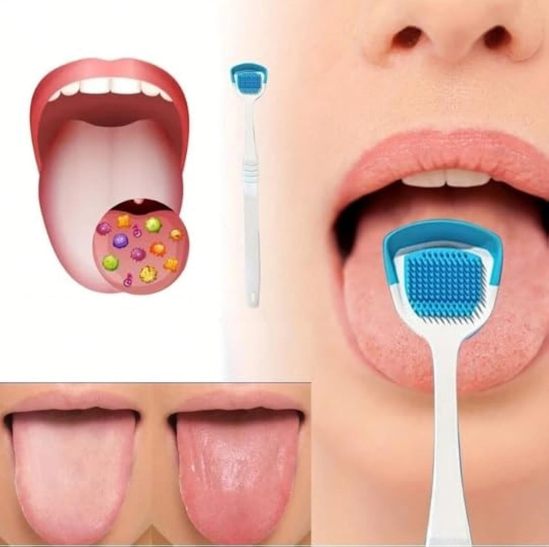 Tongue Coating Brush, Silicone Tongue Scraper, Double-Sided, Oral Hygiene, Bad Breath Remover, Random Colour