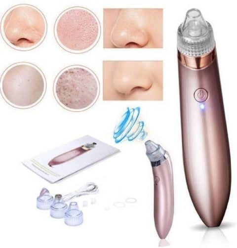 Basilica Multi-function Blackhead Remover Pore Cleaner Vacuum Suction Tool For Men And Women Blackheads Remover Tool Kit, facial pore cleaner blackheads acne remover, Pore cleaner, Blackheads Remover