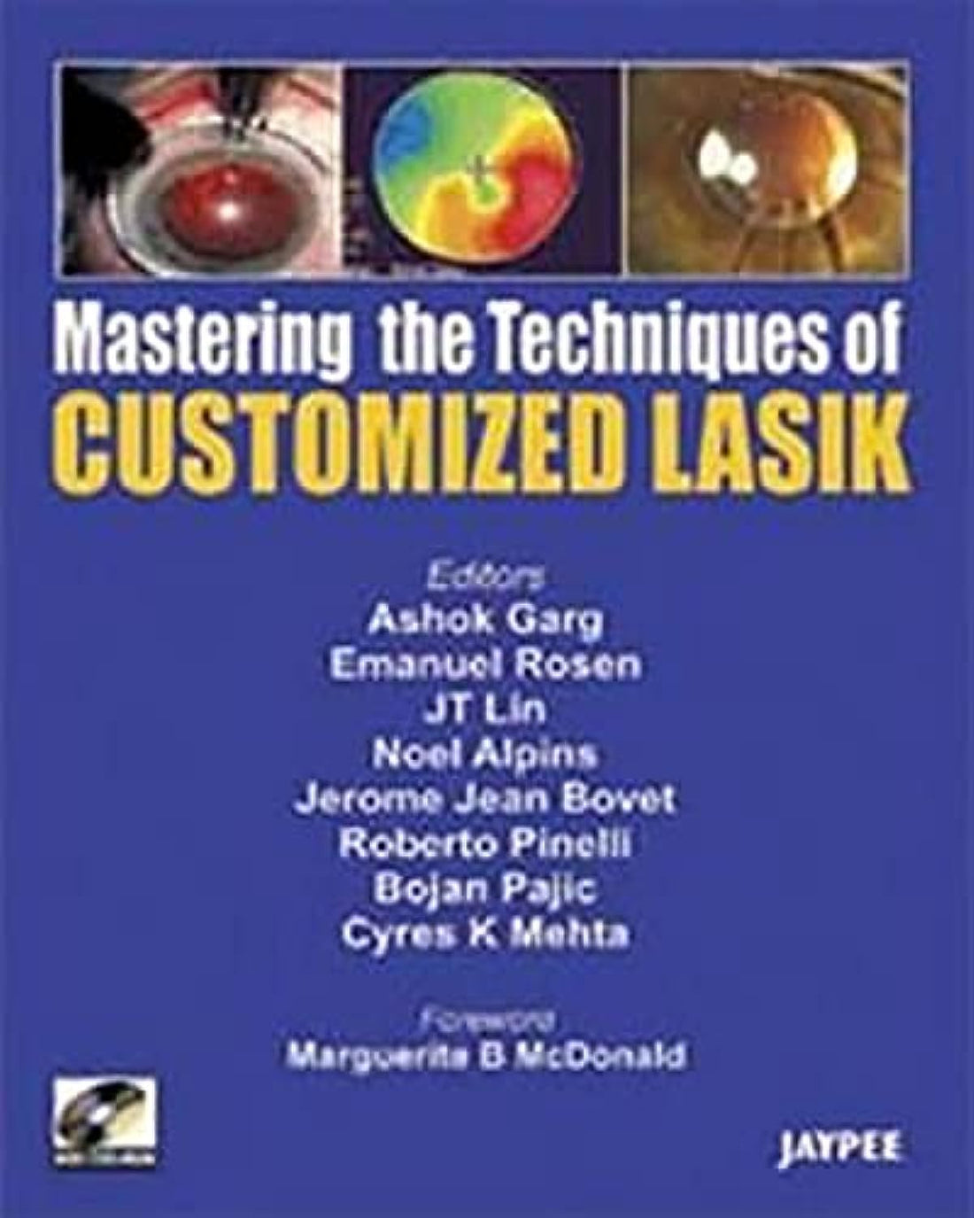 Mastering the Technique of Customized Lasik ,Ed. :1