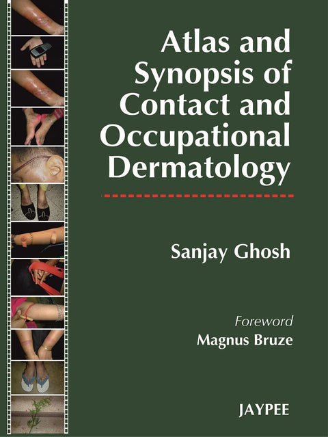 Atlas and Synopsis of Contact and Occupational Dermatology